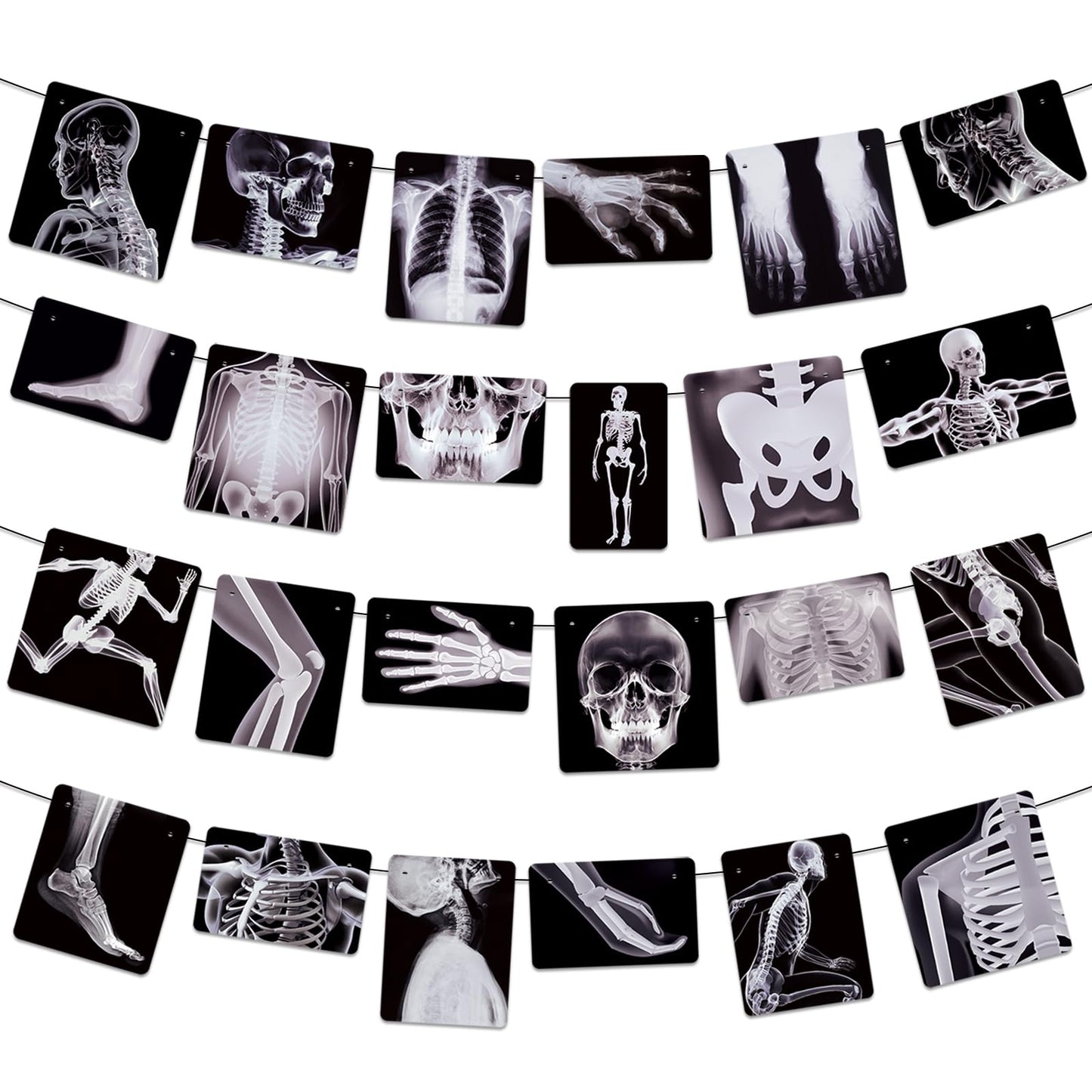 4 Strings X-Ray Skeleton Banner Decorations, Pre-Strung Medical Radiology Anatomy Garland with 24 X-Ray Body Part Images for Doctor Nurse Graduation, Halloween Party, Clinic Classroom Science Décor