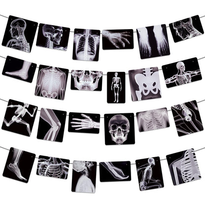 4 Strings X-Ray Skeleton Banner Decorations, Pre-Strung Medical Radiology Anatomy Garland with 24 X-Ray Body Part Images for Doctor Nurse Graduation, Halloween Party, Clinic Classroom Science Décor