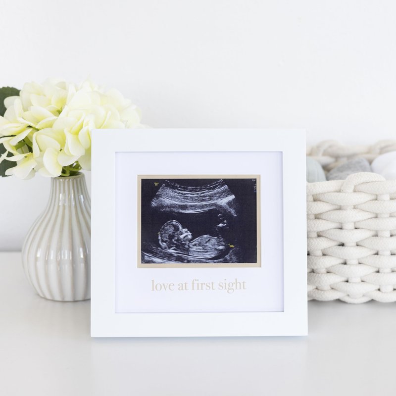 Pearhead Love At First Sight Sonogram Frame, Ultrasound Picture Frame, Pregnancy Announcement Photo Frame, Baby Keepsake Gift For Expecting Parents