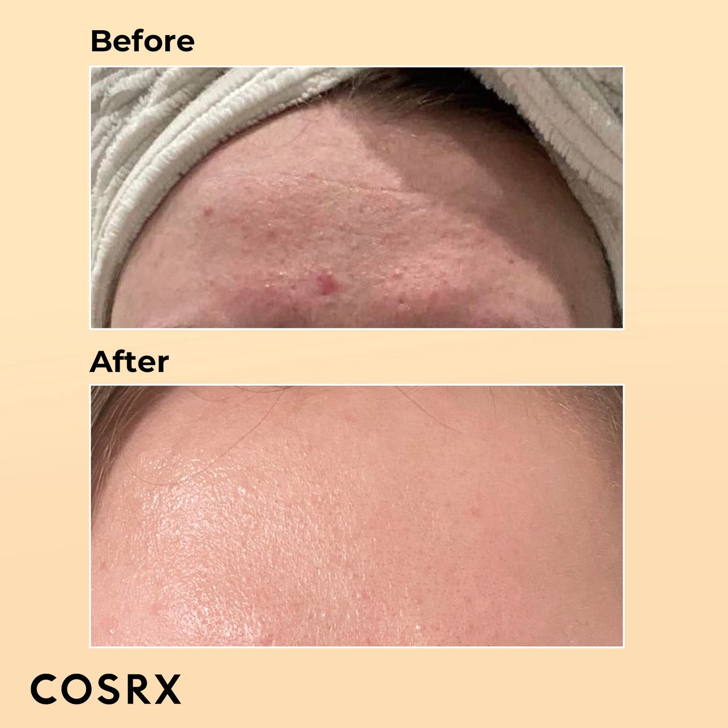 COSRX Snail Mucin 96% Power Repairing Essence 100ml, Hydrating Serum for Face with Snail Secretion Filtrate for Dull Skin & Fine Lines, Korean Skincare