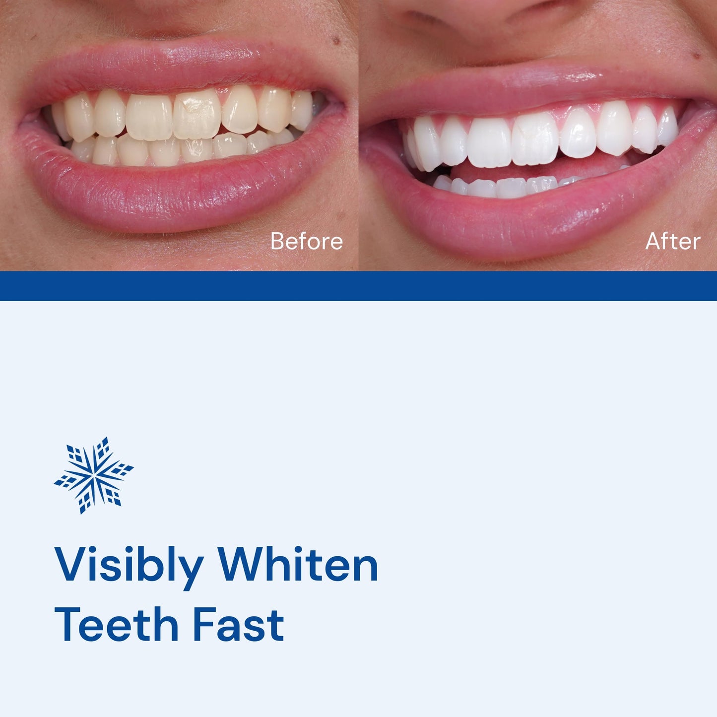 SNOW Diamond Dissolving Teeth Whitening Strips - Gentle & Enamel Safe White Strips for Teeth Whitening, at-Home Dental Hygiene & Tooth Care with Hydroxyapatite - 14 Ct