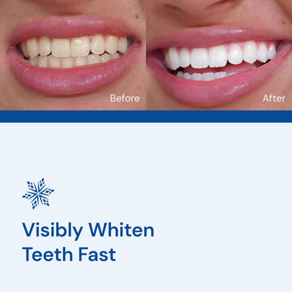 SNOW Diamond Dissolving Teeth Whitening Strips - Gentle & Enamel Safe White Strips for Teeth Whitening, at-Home Dental Hygiene & Tooth Care with Hydroxyapatite - 14 Ct