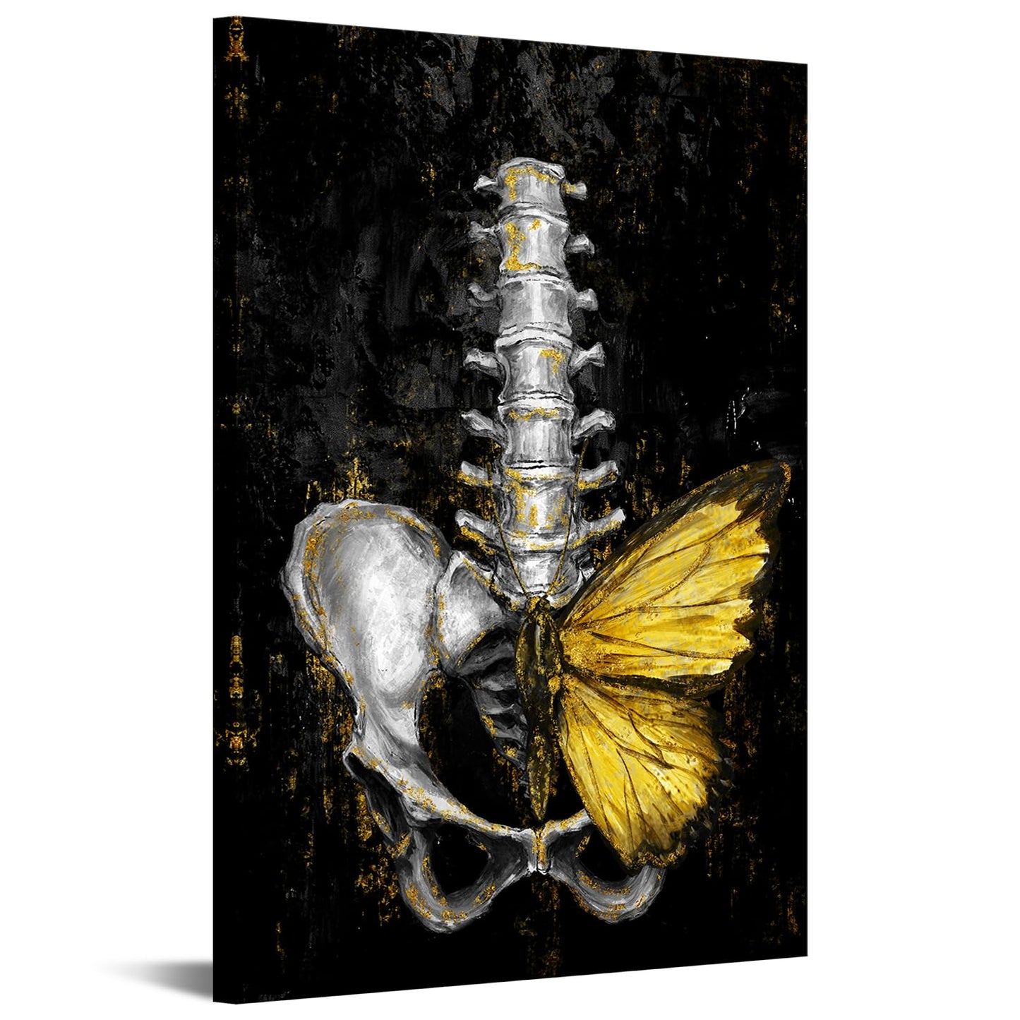 iKNOW FOTO Anatomical Spine Wall Art with Gold Butterfly 16x24 Inch Medical Skeleton Canvas Print for Doctor Office Nurse Station Physical Therapy Clinic Decor Ready to Hang